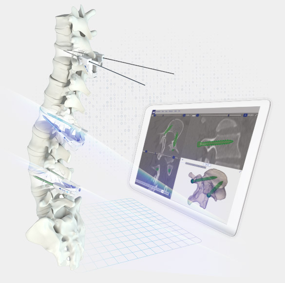 img-myspine